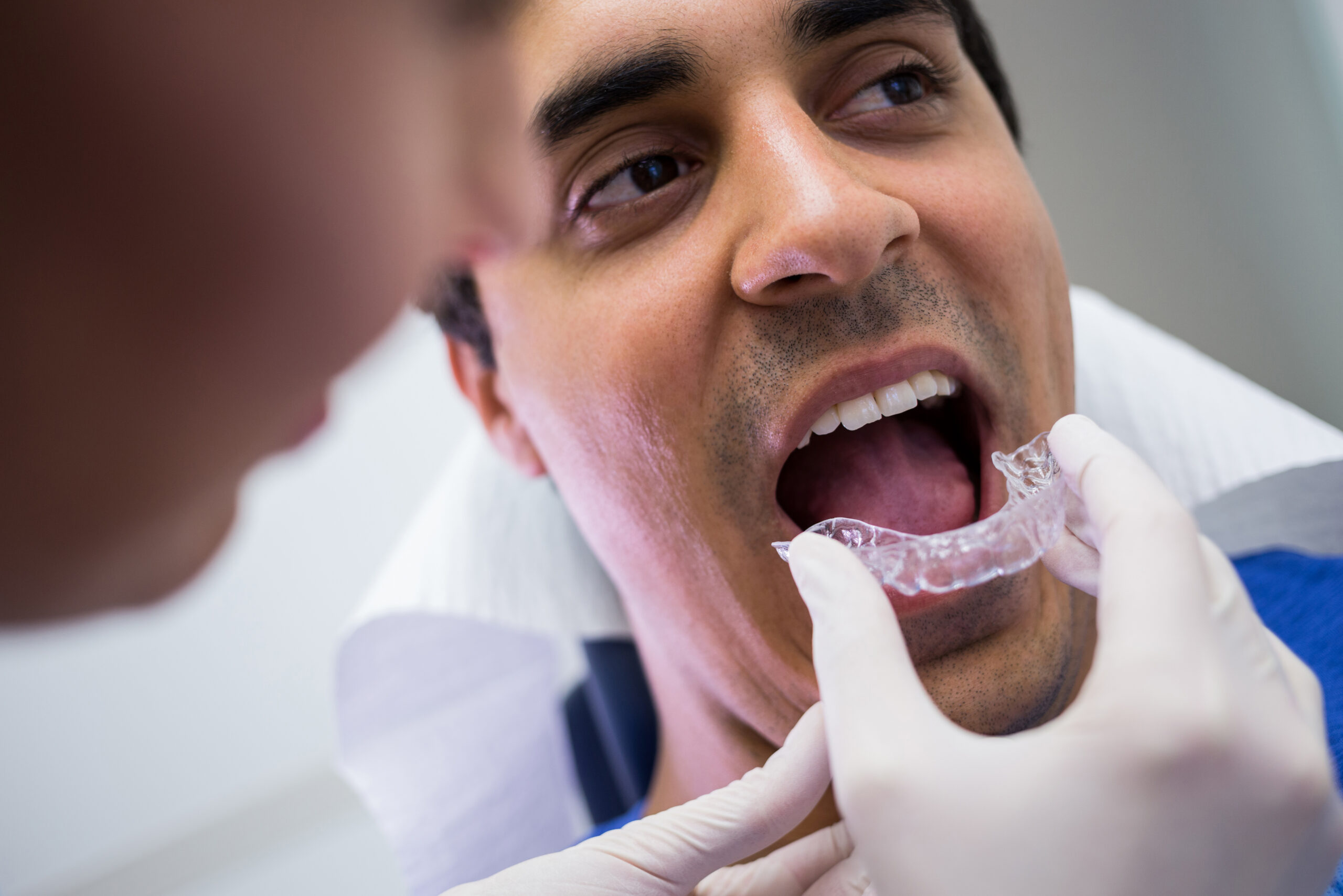 Implant-Supported Overdentures: A Secure Solution for Missing Teeth in Andheri East Mumbai
