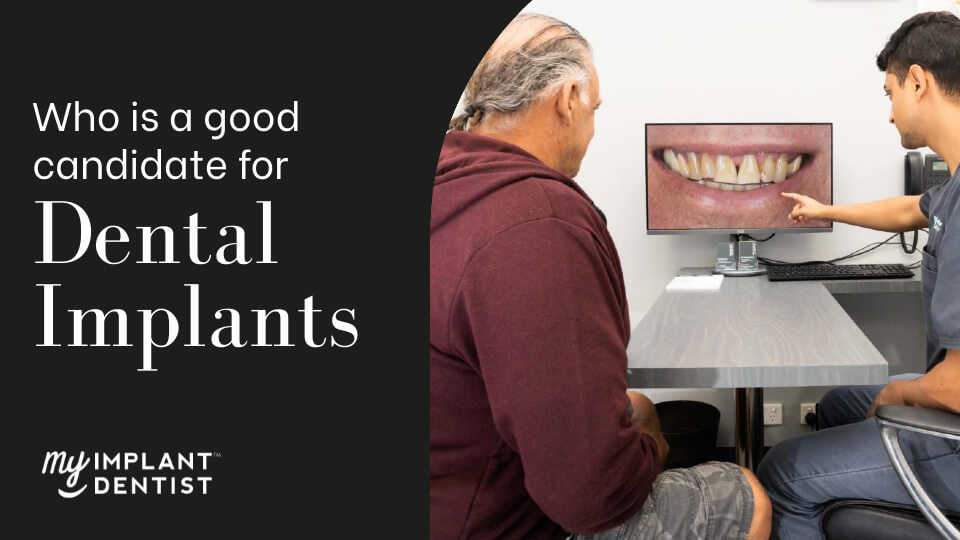 Who Is a Good Candidate for Dental Implants?